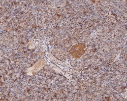 Invitrogen MDM2 Polyclonal Antibody 100 &mu;L; Unconjugated:Antibodies,