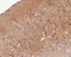 Invitrogen KCNIP1 Polyclonal Antibody 100 μL; Unconjugated:Antibodies,