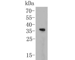 Invitrogen KCNIP1 Polyclonal Antibody 100 μL; Unconjugated:Antibodies,