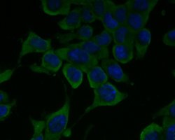 Invitrogen ENT1 Polyclonal Antibody 100 &mu;L; Unconjugated:Antibodies,