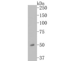 Invitrogen ENT1 Polyclonal Antibody 100 &mu;L; Unconjugated:Antibodies,