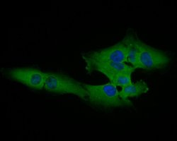 Invitrogen Cardiac Troponin C Polyclonal Antibody 100 &mu;L; Unconjugated:Antibodies,
