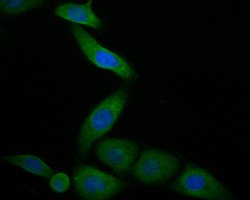 Invitrogen Cardiac Troponin C Polyclonal Antibody 100 &mu;L; Unconjugated:Antibodies,