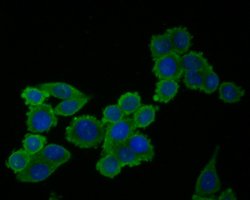 Invitrogen Cardiac Troponin C Polyclonal Antibody 100 &mu;L; Unconjugated:Antibodies,
