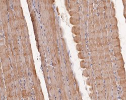Invitrogen Cardiac Troponin C Polyclonal Antibody 100 &mu;L; Unconjugated:Antibodies,