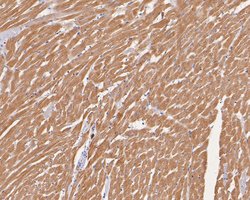 Invitrogen Cardiac Troponin C Polyclonal Antibody 100 &mu;L; Unconjugated:Antibodies,