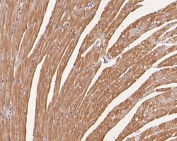Invitrogen Cardiac Troponin C Polyclonal Antibody 100 &mu;L; Unconjugated:Antibodies,