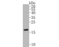 Invitrogen Cardiac Troponin C Polyclonal Antibody 100 &mu;L; Unconjugated:Antibodies,