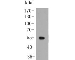 Invitrogen SARS2 Polyclonal Antibody 100 &mu;L; Unconjugated:Antibodies,