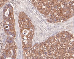 Invitrogen ENT1 Polyclonal Antibody 100 μL; Unconjugated:Antibodies,