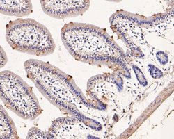 Invitrogen ENT1 Polyclonal Antibody 100 μL; Unconjugated:Antibodies,