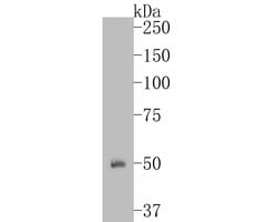Invitrogen ENT1 Polyclonal Antibody 100 μL; Unconjugated:Antibodies,