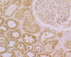 Invitrogen CLIC4 Polyclonal Antibody 100 &mu;L; Unconjugated:Antibodies,
