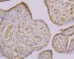 Invitrogen CLIC4 Polyclonal Antibody 100 &mu;L; Unconjugated:Antibodies,