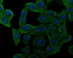 Invitrogen Nhe-1 Polyclonal Antibody 100 &mu;L; Unconjugated:Antibodies,