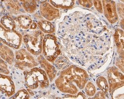 Invitrogen Nhe-1 Polyclonal Antibody 100 &mu;L; Unconjugated:Antibodies,