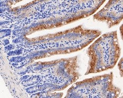 Invitrogen Nhe-1 Polyclonal Antibody 100 &mu;L; Unconjugated:Antibodies,