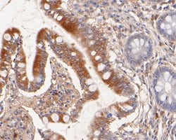 Invitrogen Nhe-1 Polyclonal Antibody 100 &mu;L; Unconjugated:Antibodies,