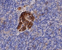 Invitrogen KIDINS220 Polyclonal Antibody 100 &mu;L; Unconjugated:Antibodies,