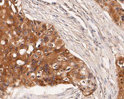 Invitrogen KIDINS220 Polyclonal Antibody 100 &mu;L; Unconjugated:Antibodies,