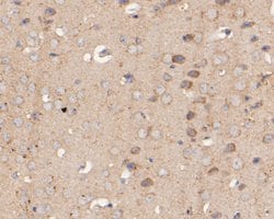 Invitrogen KIDINS220 Polyclonal Antibody 100 &mu;L; Unconjugated:Antibodies,