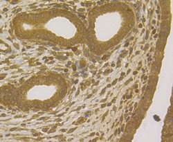 Invitrogen TRF2 Polyclonal Antibody 100 &mu;L; Unconjugated:Antibodies,