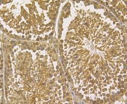 Invitrogen TRF2 Polyclonal Antibody 100 &mu;L; Unconjugated:Antibodies,