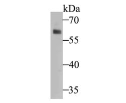 Invitrogen TRF2 Polyclonal Antibody 100 &mu;L; Unconjugated:Antibodies,