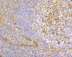 Invitrogen Thymidine Phosphorylase Polyclonal Antibody 100 &mu;L; Unconjugated:Antibodies,