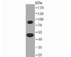 Invitrogen Thymidine Phosphorylase Polyclonal Antibody 100 &mu;L; Unconjugated:Antibodies,