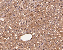 Invitrogen Rab11 FIB3 Polyclonal Antibody 100 &mu;L; Unconjugated:Antibodies,