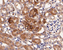 Invitrogen Rab11 FIB3 Polyclonal Antibody 100 &mu;L; Unconjugated:Antibodies,