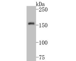 Invitrogen TRPM4 Polyclonal Antibody 100 &mu;L; Unconjugated:Antibodies,