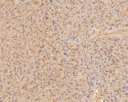Invitrogen COX5B Polyclonal Antibody 100 &mu;L; Unconjugated:Antibodies,