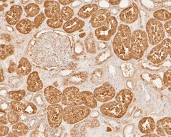 Invitrogen COX5B Polyclonal Antibody 100 &mu;L; Unconjugated:Antibodies,
