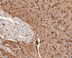 Invitrogen Aldolase B Polyclonal Antibody 100 &mu;L | Buy Online | Invitrogen&trade; | Fisher Scientific