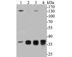 Invitrogen Aldolase B Polyclonal Antibody 100 &mu;L | Buy Online | Invitrogen&trade; | Fisher Scientific