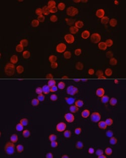 Invitrogen TEC Polyclonal Antibody 100 &mu;L; Unconjugated:Antibodies,