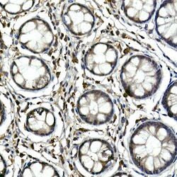 Invitrogen TEC Polyclonal Antibody 100 &mu;L; Unconjugated:Antibodies,
