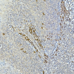 Invitrogen TEC Polyclonal Antibody 100 &mu;L; Unconjugated:Antibodies,