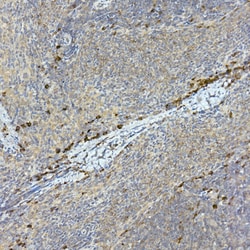 Invitrogen TEC Polyclonal Antibody 100 &mu;L; Unconjugated:Antibodies,