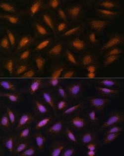 Invitrogen FGF2 Polyclonal Antibody 100 &mu;L | Buy Online | Invitrogen&trade; | Fisher Scientific