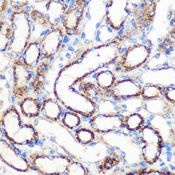 Invitrogen FGF2 Polyclonal Antibody 100 &mu;L | Buy Online | Invitrogen&trade; | Fisher Scientific