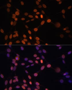 Invitrogen Lamin A/C Polyclonal Antibody 100 &mu;L; Unconjugated:Antibodies,