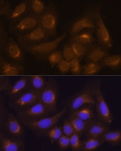 Invitrogen Caspase 9 Polyclonal Antibody 100 &mu;L; Unconjugated:Antibodies,