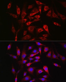 Invitrogen SOCS3 Polyclonal Antibody 100 &mu;L; Unconjugated:Antibodies,