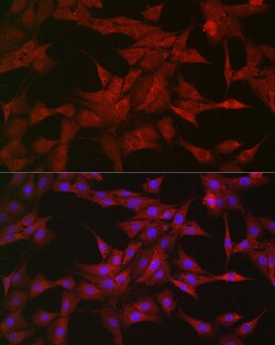 Invitrogen SOCS3 Polyclonal Antibody 100 &mu;L; Unconjugated:Antibodies,