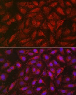 Invitrogen SOCS3 Polyclonal Antibody 100 &mu;L; Unconjugated:Antibodies,