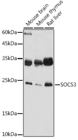 Invitrogen SOCS3 Polyclonal Antibody 100 &mu;L; Unconjugated:Antibodies,