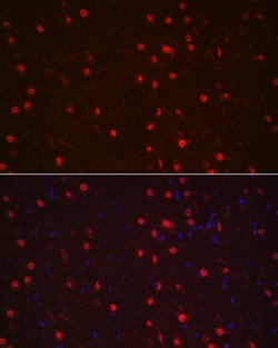 Invitrogen NeuN Polyclonal Antibody 100 &mu;L; Unconjugated:Antibodies,